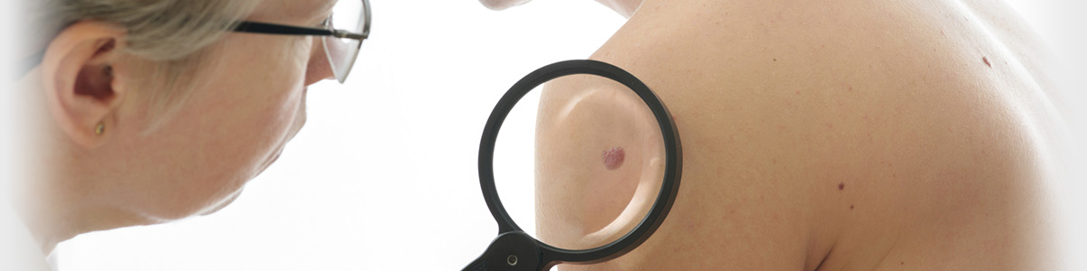 Dermatologist in Ontario CA — Dermatology clinic in Ontario, CA — photo 5